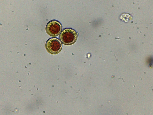 Haematococcus pluvialis e philodina